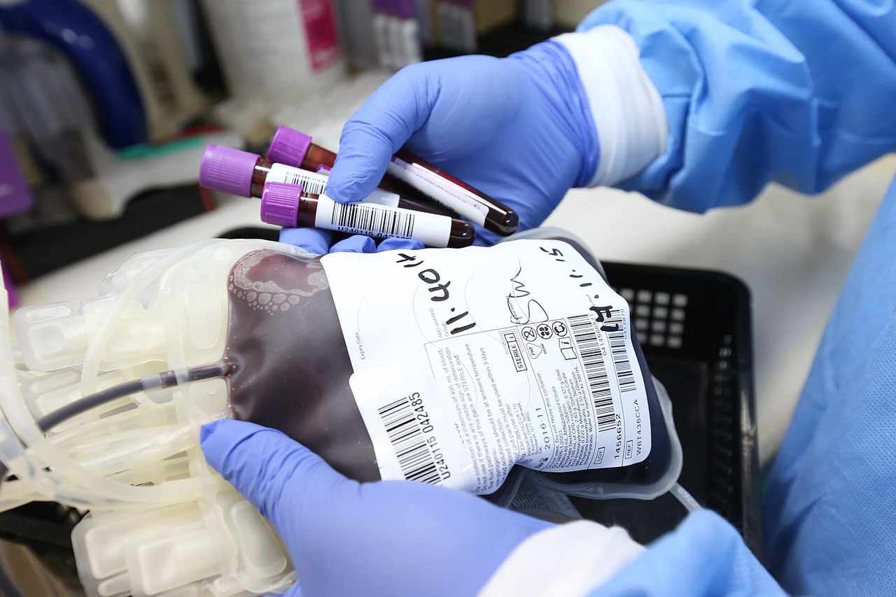 "Dies a quo" ed emotrasfusione con sangue infetto